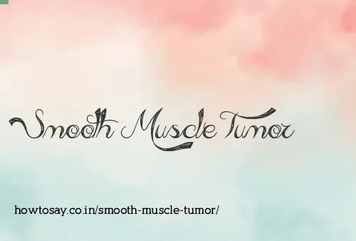 Smooth Muscle Tumor
