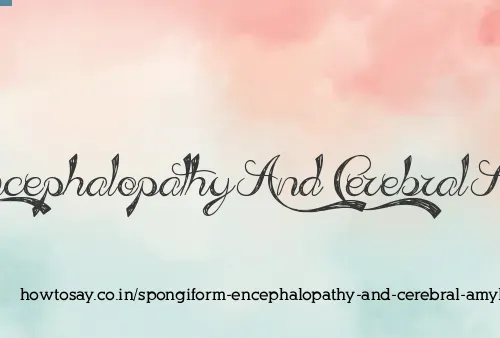 Spongiform Encephalopathy And Cerebral Amyloidosis
