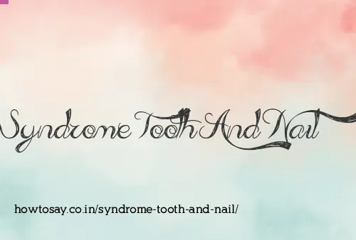 Syndrome Tooth And Nail
