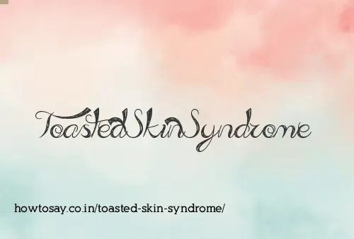 Toasted Skin Syndrome