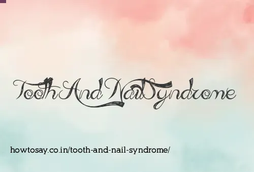 Tooth And Nail Syndrome