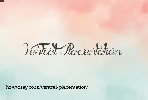Ventral Placentation