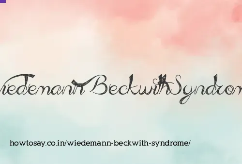 Wiedemann Beckwith Syndrome